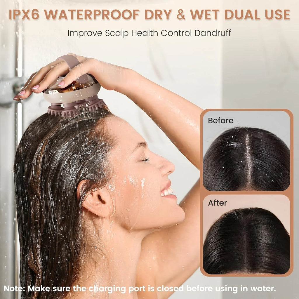 Scalp Massager - מעסה קרקפת חשמלי נטען ועמיד למים – להרפיית מתח ועיסוי ראש.